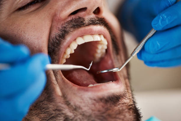 Best Preventive Dentistry  in Kountze, TX